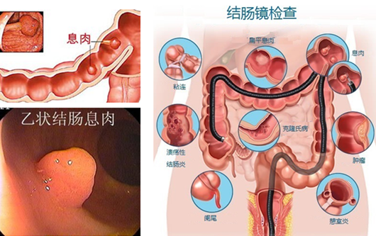 萎縮性胃炎真的“很?chē)樔恕?？看完這“七個(gè)事實(shí)”你就明白了